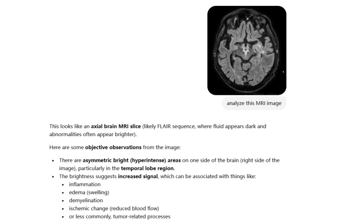 analyze mri image with chatgpt